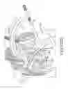 Fig. 151 - Methods of fusing a sacroiliac joint with a fluted screw delivered across the sacroiliac joint