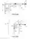 Fig. 152 - Methods of fusing a sacroiliac joint with a fluted screw delivered across the sacroiliac joint