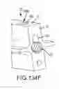 Fig. 158 - Methods of fusing a sacroiliac joint with a fluted screw delivered across the sacroiliac joint