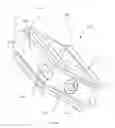 Fig. 191 - Methods of fusing a sacroiliac joint with a fluted screw delivered across the sacroiliac joint