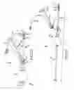 Fig. 20 - Methods of fusing a sacroiliac joint with a fluted screw delivered across the sacroiliac joint