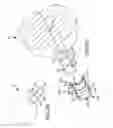 Fig. 45 - Methods of fusing a sacroiliac joint with a fluted screw delivered across the sacroiliac joint