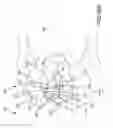 Fig. 55 - Methods of fusing a sacroiliac joint with a fluted screw delivered across the sacroiliac joint