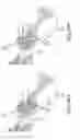 Fig. 63 - Methods of fusing a sacroiliac joint with a fluted screw delivered across the sacroiliac joint