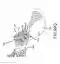 Fig. 64 - Methods of fusing a sacroiliac joint with a fluted screw delivered across the sacroiliac joint
