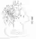 Fig. 75 - Methods of fusing a sacroiliac joint with a fluted screw delivered across the sacroiliac joint