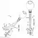 Fig. 80 - Methods of fusing a sacroiliac joint with a fluted screw delivered across the sacroiliac joint