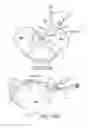 Fig. 83 - Methods of fusing a sacroiliac joint with a fluted screw delivered across the sacroiliac joint