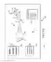 Fig. 86 - Methods of fusing a sacroiliac joint with a fluted screw delivered across the sacroiliac joint