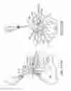 Fig. 90 - Methods of fusing a sacroiliac joint with a fluted screw delivered across the sacroiliac joint