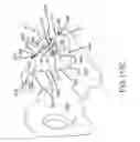 Fig. 91 - Methods of fusing a sacroiliac joint with a fluted screw delivered across the sacroiliac joint