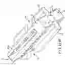 Fig. 98 - Methods of fusing a sacroiliac joint with a fluted screw delivered across the sacroiliac joint