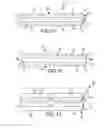 Fig. 06 - Methods of fusing a sacroiliac joint with a threaded joint fixation screw having a plurality of openings therein