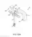 Fig. 147 - Methods of fusing a sacroiliac joint with a threaded joint fixation screw having a plurality of openings therein