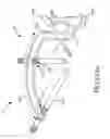Fig. 149 - Methods of fusing a sacroiliac joint with a threaded joint fixation screw having a plurality of openings therein