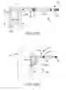 Fig. 152 - Methods of fusing a sacroiliac joint with a threaded joint fixation screw having a plurality of openings therein