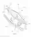 Fig. 191 - Methods of fusing a sacroiliac joint with a threaded joint fixation screw having a plurality of openings therein