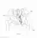 Fig. 216 - Methods of fusing a sacroiliac joint with a threaded joint fixation screw having a plurality of openings therein