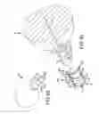 Fig. 45 - Methods of fusing a sacroiliac joint with a threaded joint fixation screw having a plurality of openings therein