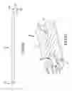 Fig. 47 - Methods of fusing a sacroiliac joint with a threaded joint fixation screw having a plurality of openings therein