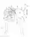 Fig. 53 - Methods of fusing a sacroiliac joint with a threaded joint fixation screw having a plurality of openings therein