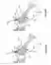 Fig. 58 - Methods of fusing a sacroiliac joint with a threaded joint fixation screw having a plurality of openings therein