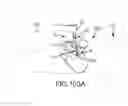 Fig. 71 - Methods of fusing a sacroiliac joint with a threaded joint fixation screw having a plurality of openings therein