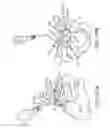 Fig. 90 - Methods of fusing a sacroiliac joint with a threaded joint fixation screw having a plurality of openings therein