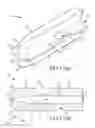 Fig. 95 - Methods of fusing a sacroiliac joint with a threaded joint fixation screw having a plurality of openings therein