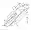 Fig. 98 - Methods of fusing a sacroiliac joint with a threaded joint fixation screw having a plurality of openings therein