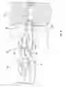Fig. 09 - Endoscopically implantable inflatable interbody fusion device