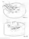 Fig. 46 - System for processing bone stock including a bone cleaning head, a bone milling head and base that powers both the cleaning head and the milling head