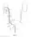 Fig. 08 - Telescoping ureteral stent