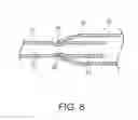 Fig. 09 - Telescoping ureteral stent