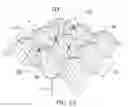 Fig. 02 - Stents with improved fixation