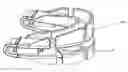 Fig. 01 - Adjustable oral devices for preventing or reducing snoring or obstructive sleep apnea (OSA)
