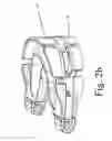 Fig. 04 - Adjustable oral devices for preventing or reducing snoring or obstructive sleep apnea (OSA)
