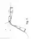 Fig. 08 - Adjustable oral devices for preventing or reducing snoring or obstructive sleep apnea (OSA)