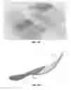Fig. 02 - Heating devices