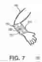 Fig. 08 - ACCELERATED TRANSITION THERMAL CONTRAST THERAPY DEVICE