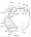 Fig. 22 - Washable diaper