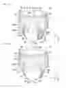 Fig. 02 - Disposable absorbent wearing article