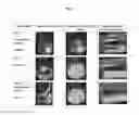 Fig. 02 - Injectable sterile aqueous formulation based on crosslinked hyaluronic acid and hydroxyapatite for aesthetic use