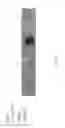 Fig. 14 - FORMULATIONS INCLUDING SILVER NANOPARTICLES AND METHODS OF USING THE SAME