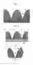 Fig. 07 - MICRONEEDLE ARRAY