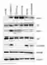 Fig. 01 - NANOLIPOSOMAL FORMULATION FOR TARGETING INTEGRIN-LINKED KINASE (ILK) WITH SMALL-INTERFERENCE RNA AND A METHOD FOR TREATING OVARIAN CANCER