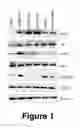 Fig. 02 - NANOLIPOSOMAL FORMULATION FOR TARGETING INTEGRIN-LINKED KINASE (ILK) WITH SMALL-INTERFERENCE RNA AND A METHOD FOR TREATING OVARIAN CANCER