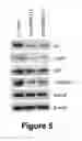 Fig. 06 - NANOLIPOSOMAL FORMULATION FOR TARGETING INTEGRIN-LINKED KINASE (ILK) WITH SMALL-INTERFERENCE RNA AND A METHOD FOR TREATING OVARIAN CANCER