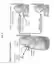 Fig. 02 - Implantable drug delivery compositions and methods of use thereof