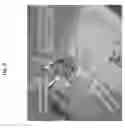 Fig. 10 - Implantable drug delivery compositions and methods of use thereof